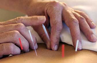 Instituto Brasileiro de Acupuntura e Massoterapia - Foto 1