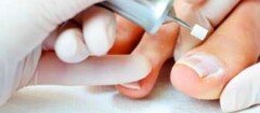podologia-e-podologos-piracicaba-1468268550